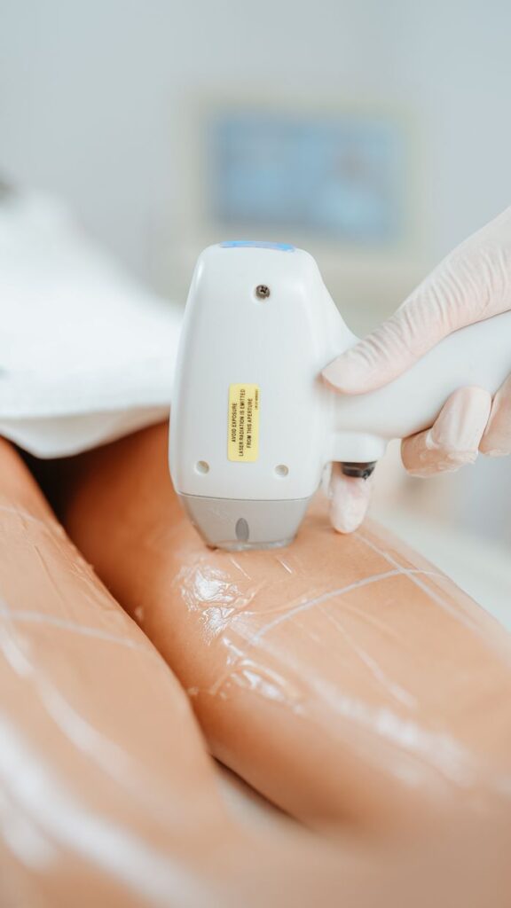 Close-up of laser hair removal treatment in a beauty clinic focusing on smooth legs.